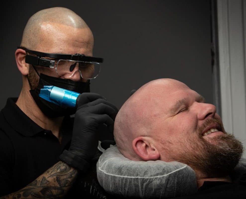 Scalp Micropigmentation Scotland